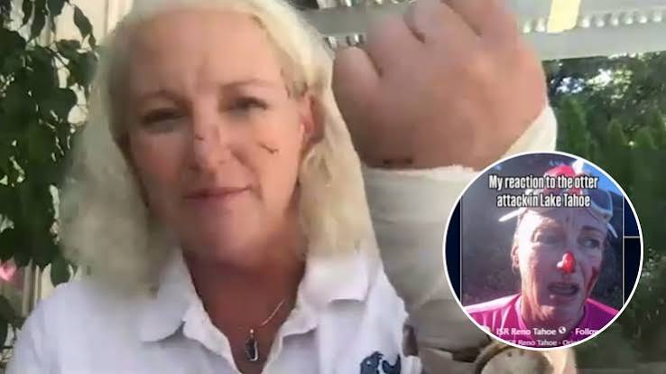 Lake Tahoe Otter Attack Leaves Swimmer With 38 Stitches
